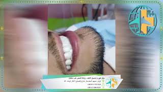 preview picture of video 'ابتسامة هولیوود بمرکز طب ماهان فی مشهد المقدسة'
