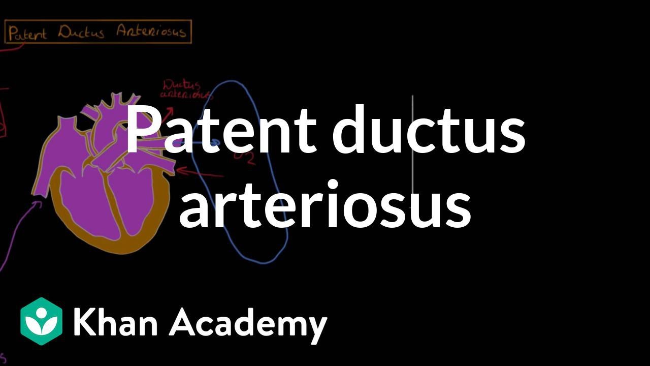 Patent ductus arteriosus | Circulatory System and Disease | NCLEX-RN | Khan Academy