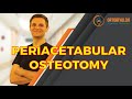 PERIACETABULAR OSTEOTOMY / GANZ OSTEOTOMY
