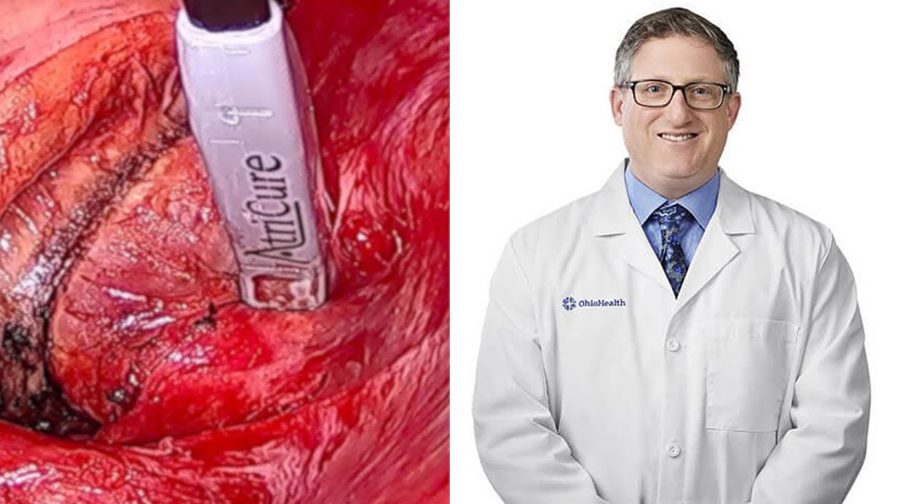 Dr. Eric Okum – Intraoperative Testing of the Posterior Left Atrium During Surgical Ablation