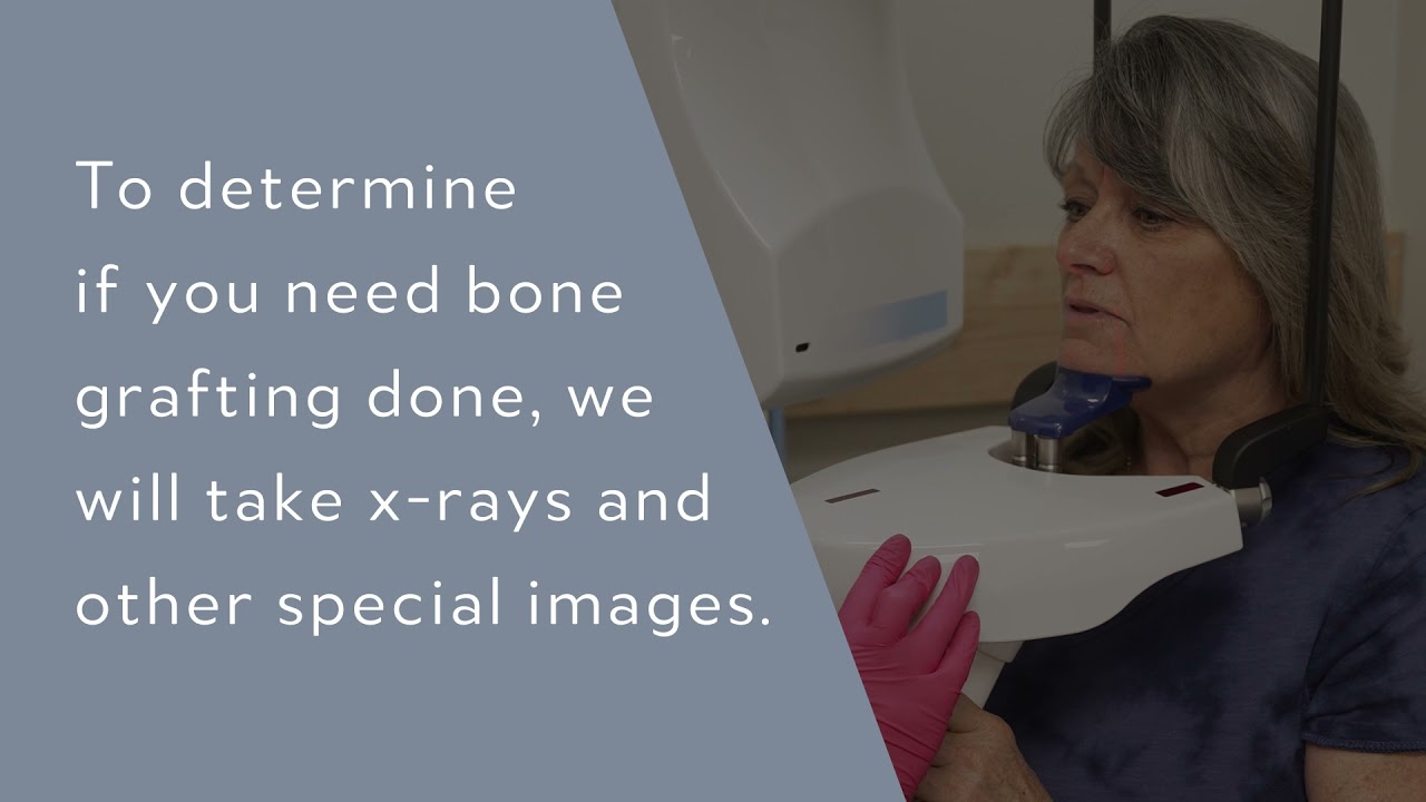 bone grafting explained