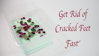 Get Rid of Cracked Feet Fast