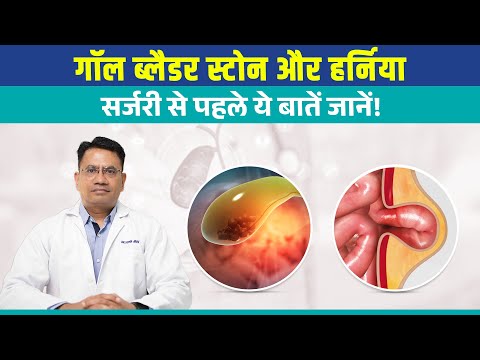 Recovery after hernia surgery — day-by-day