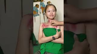 Download lagu kerokan dada dan leher menghilangkan nyesek karena masuk angin #kerokan #massage #demam #mual #munta mp3