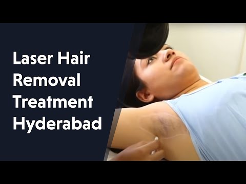 download lagu mp3 mp4 Underarms Hair Removal Laser Cost India, download lagu Underarms Hair Removal Laser Cost India gratis, unduh video klip Underarms Hair Removal Laser Cost India