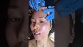 This facial promises a GLOWING face: Korean Facial spa Hamptons #shortvideo #facial #hampton