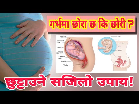 Garbhama xora xa ki xori | How to know if you have a boy or a girl in womb | Nepal Sanjal