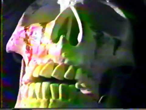 OverDose Live at Ginástico 19/04/1986 ("Seculo XX" release in Belo Horizonte, MG, Brazil)