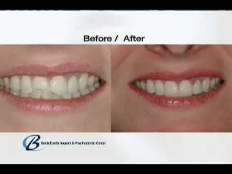 What Is a Prosthodontist?