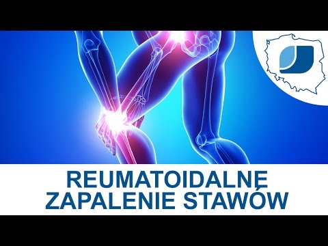 Deformacja stóp w czasie ciąży Ból kości w rejonie dużego palca