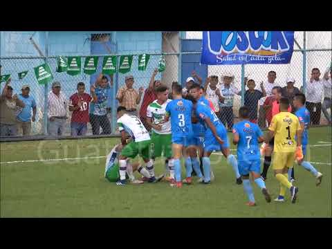 Video Sanarate 0 0 Antigua GFC