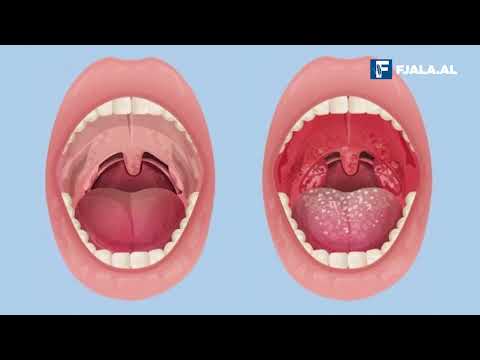 Gjashtë organet e “pa nevojshme” në trupin e njeriut