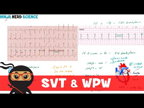 Rate and Rhythm Normal Sinus Rhythm