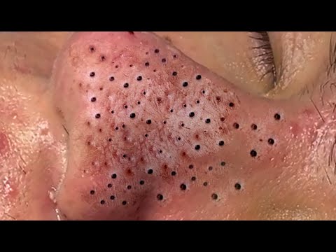 Enjoy Your Day With Hien Nguyen Spa # 1284