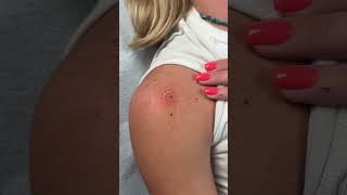 A tiny heart shaped freckle for Kennedy ♡