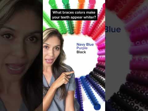 Best Braces Colors to Make Your Teeth Look Whiter