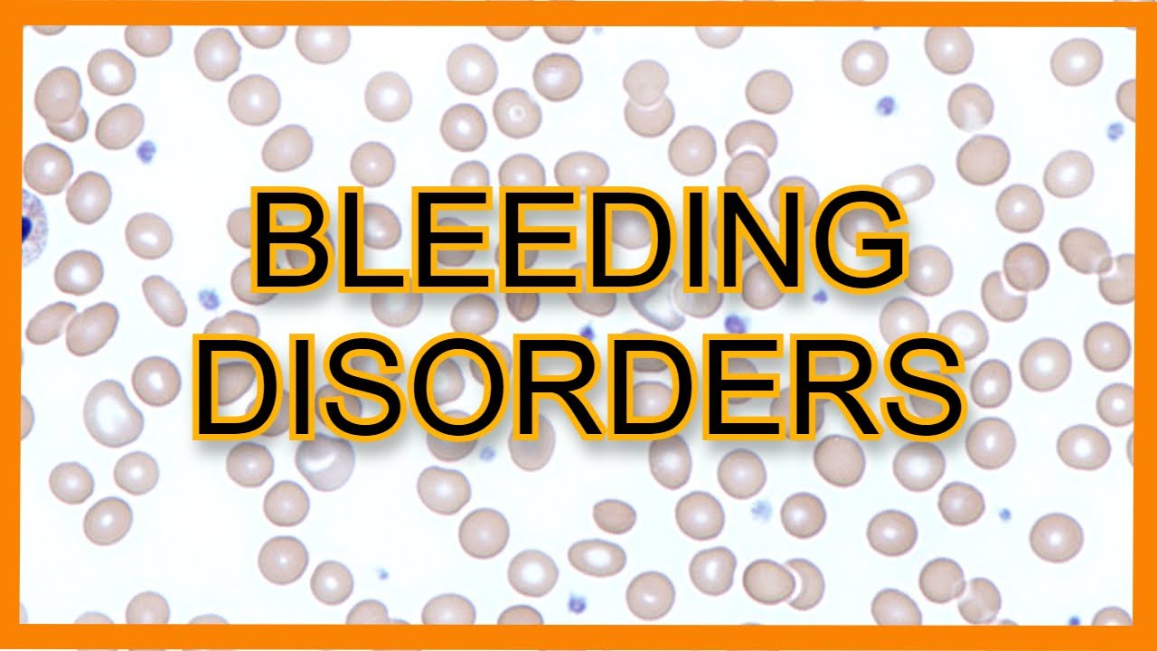 Bleeding Disorders (ITP vs TTP vs HUS vs DIC) || USMLE