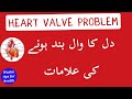 Dill Ka Wall Band Hone Ki Alamat Wasim Tips