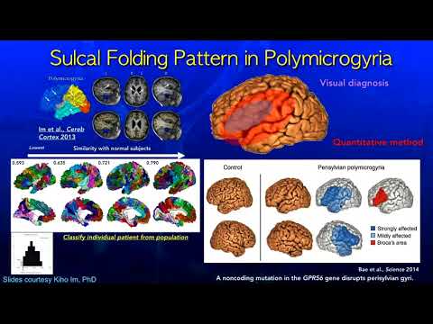 ISMRM MR Academy - Taking Imaging To The Next Level: Structural Insights Using Surface Based & ...