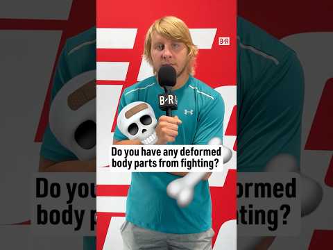 UFC fighters showing off their injuries 🥴