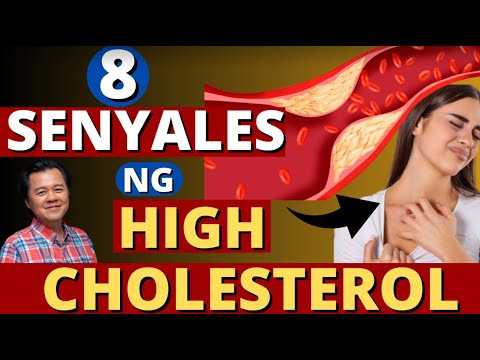 8 Senyales ng High Cholesterol. Delikado Ba Ito? - By Doc Willie Ong (Internist and Cardiologist)