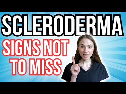 Signs Of Scleroderma NOT TO MISS