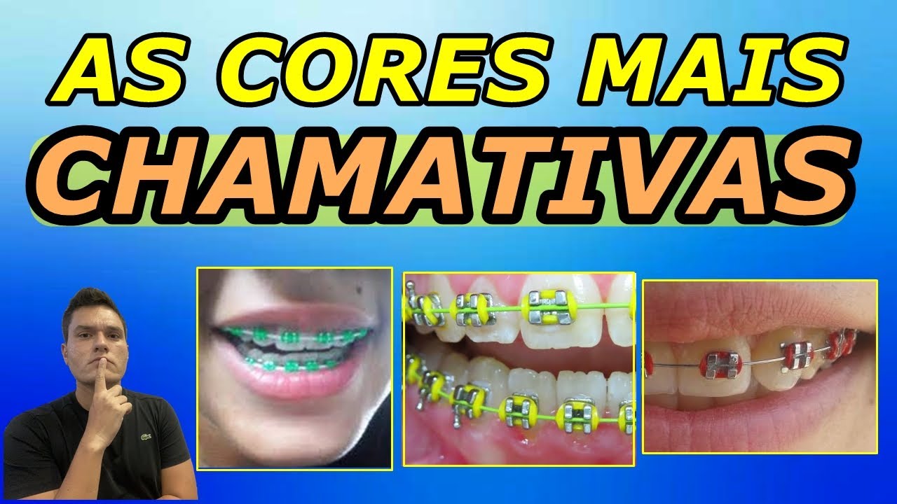 Watch Now TOP 10 CORES MAIS CHAMATIVAS PARA BORRACHINHAS DO APARELHO ORTODÔNTICO | CORES MAIS DESTACADAS!!! TOP 10 CORES MAIS CHAMATIVAS PARA BORRACHINHAS DO APARELHO ORTODÔNTICO | CORES MAIS DESTACADAS!!!