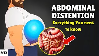 Abdominal Distention: What’s Causing Your Belly to Swell, When to Worry & How to Fix It!