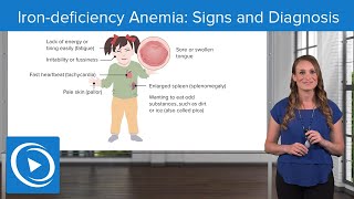 Iron-deficiency Anemia: Signs and Diagnosis – Pediatric Nursing | Lecturio Nursing