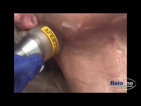 Fisioline anti-aging laser treatment