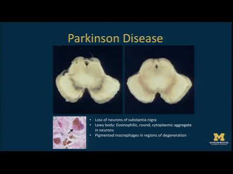 Neural Prosthesis Seminar - Parag G Patil, MD, PhD