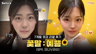 꽃말: 예쁨🌼｜리얼후기