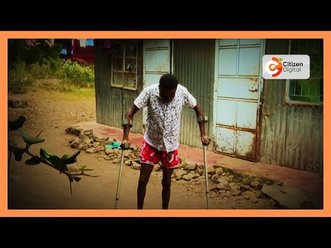 Victims of police brutality nurse life changing injuries after June 25th protests