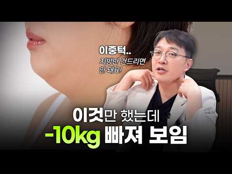 이중턱 연조직 묶기와 지방흡입 차이와 투턱삭제술까지 필요한 경우ㅣ이중턱 연조직 묶기투턱삭제술병행ㅣ디에이성형외과