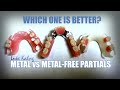 Metal Vs Metal Free Partials Which Is Best