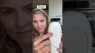 Iris Laser Full Demo and FAQs