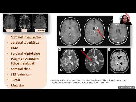 Emek Gerektiren Olgular EGO 27 subat 2025