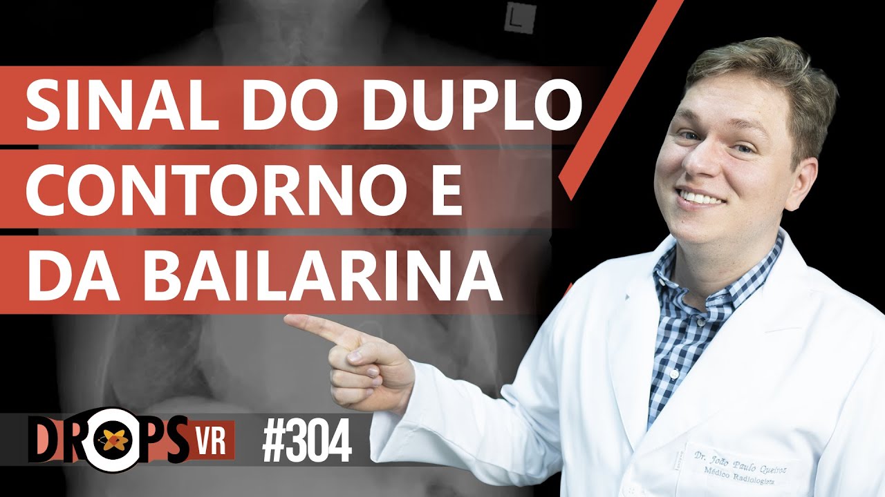 SINAL DO DUPLO CONTORNO E SINAL DA BAILARINA - O QUE SIGNIFICAM?