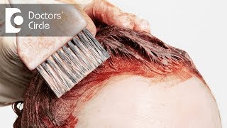 How to manage allergies due to hair dyes? - Dr. Rasya Dixit