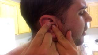 Pimple popping: inner ear