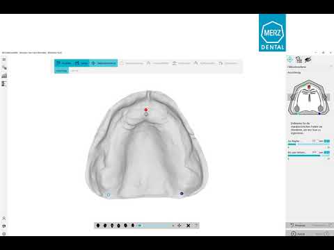 Konstruktion Funktionslöffel + Bißregistrat | BDCreator® PLUS | #BalticDentureSystem