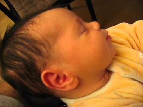Decolorazione di crema per il viso di chiarificazione Il pigmentary nota su una faccia dopo risposte di posti