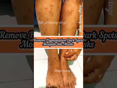 How To Get Rid Of Dark Spots Scar, Mosquito Bites Pigmentation #darkspots #skincare#viral