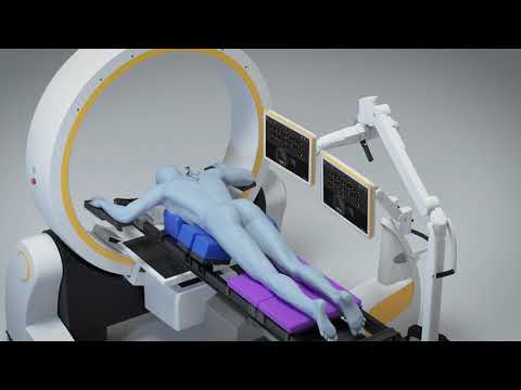 Loop X Mobile Robotic Imaging Brainlab