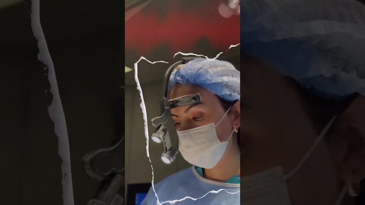 Revizyon Rinoplasti - Video 3