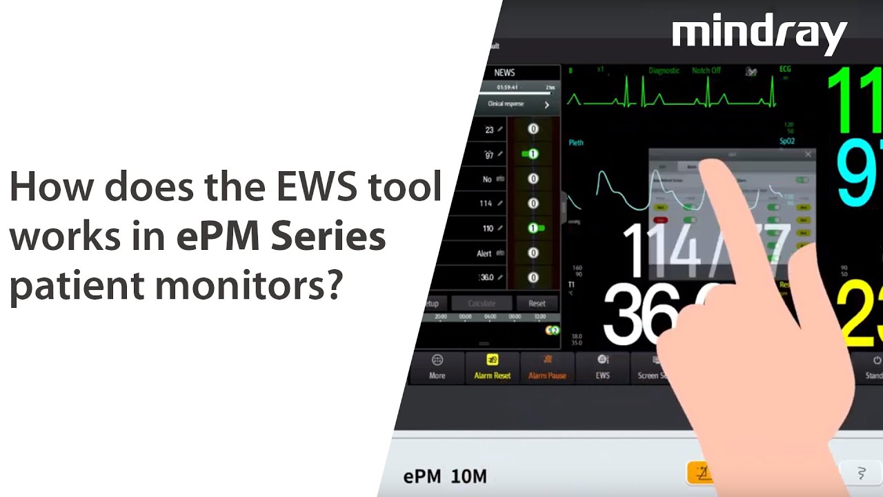 How does the EWS tool works in ePM Series patient monitors?