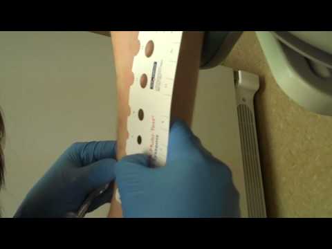 Skin Prick Allergy Testing Results-Northwest ENT and Allergy