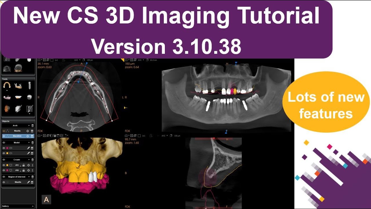 New CS 3D Imaging Tutorial - Version 3.10.38