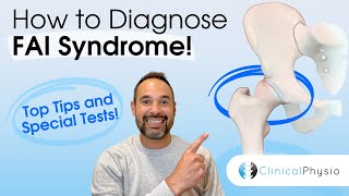 How to Diagnose FAI | Physio explains top tips, signs and tests for femoroacetabular impingement!