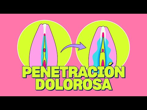 ¿Es normal sentir dolor durante la penetración?